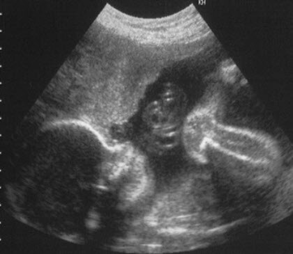 28 Недель Беременности Фото Мальчика